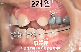 수술후