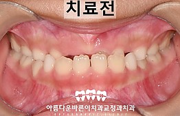 수술전