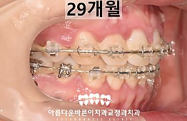 수술후