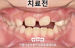 수술전