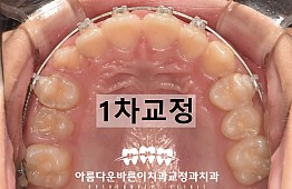 수술후