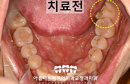 수술전