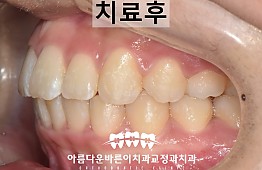 수술후