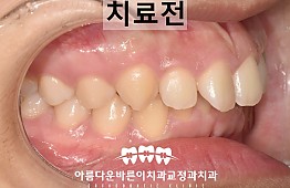 수술전