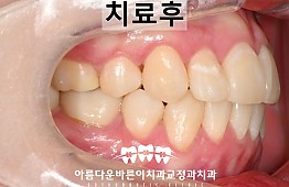 수술후