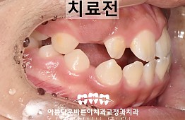 수술전