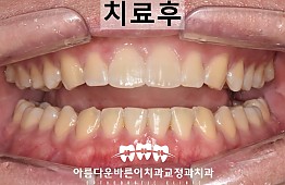 수술후