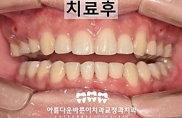 수술후
