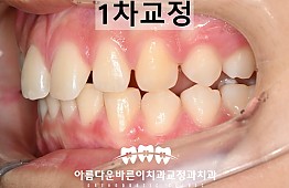 수술후