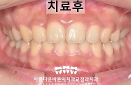 수술후