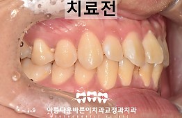 수술전