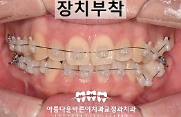 수술후