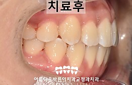 수술후