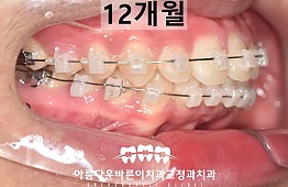 수술후