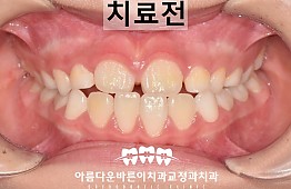 수술전