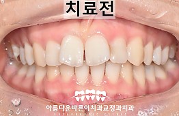 수술전