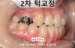 수술후