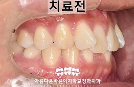 수술전