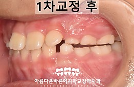 수술후