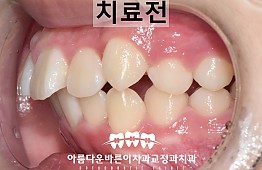 수술전