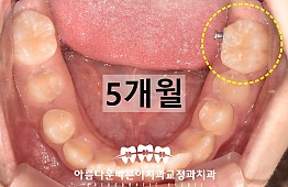 수술후