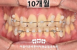 수술후
