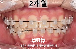 수술후
