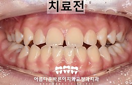 수술전