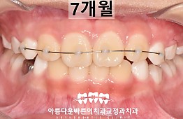 수술후