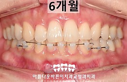 수술후