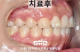 수술후
