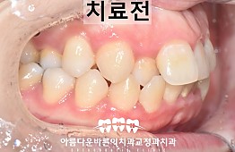 수술전