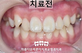 수술전