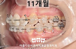 수술후