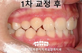 수술후
