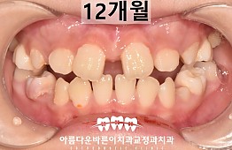 수술후