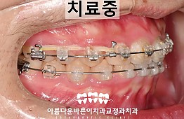 수술후