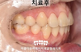 수술후