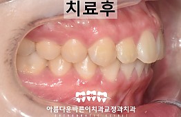 수술후