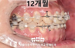 수술후