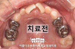 수술전