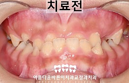 수술전