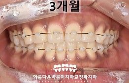 수술후