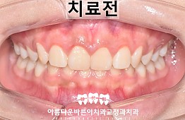 수술전