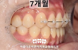 수술후