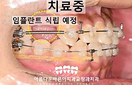 수술후