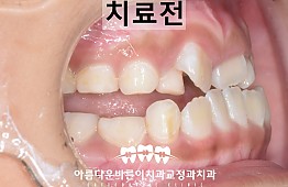 수술전