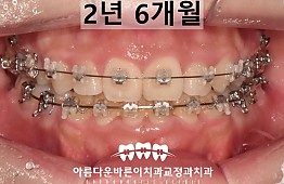 수술후