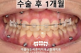 수술후
