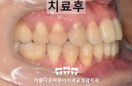 수술후